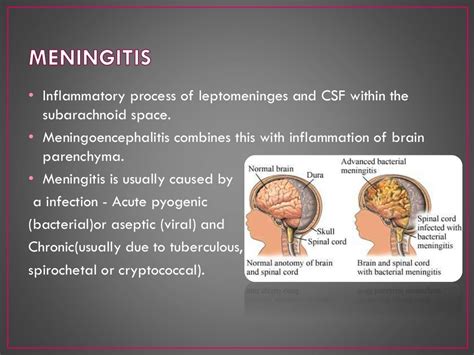 laboratory diagnosis of bacterial meningitis